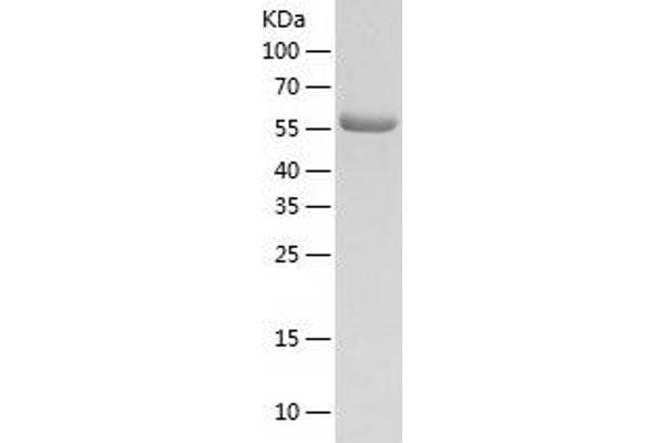 KARS Protein (AA 63-597) (His tag)