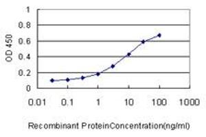 Detection limit for recombinant GST tagged MTUS1 is approximately 0. (MTUS1 抗体  (AA 1-240))