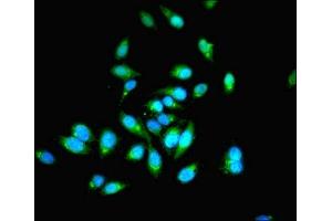 Immunofluorescent analysis of Hela cells using ABIN7142079 at dilution of 1:100 and Alexa Fluor 488-congugated AffiniPure Goat Anti-Rabbit IgG(H+L) (PHPT1 抗体  (AA 1-125))