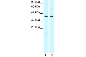 PTGER3 antibody used at 2. (PTGER3 抗体)