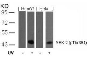 Image no. 2 for anti-Mitogen-Activated Protein Kinase Kinase 2 (MAP2K2) (pThr394) antibody (ABIN196623) (MEK2 抗体  (pThr394))