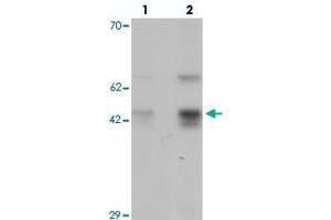 Western blot analysis of SLC35D3 in HeLa cell lysate with SLC35D3 polyclonal antibody  at (lane 1) 1 and (lane 2) 2 ug/mL. (SLC35D3 抗体  (C-Term))