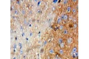 Used in DAB staining on fromalin fixed paraffin-embedded Brain tissue (FIL1d 抗体  (AA 12-151))