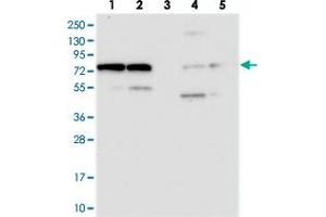 Western blot analysis of Lane 1: RT-4, Lane 2: U-251 MG, Lane 3: Human Plasma, Lane 4: Liver, Lane 5: Tonsil with KARS polyclonal antibody  at 1:250-1:500 dilution. (KARS 抗体)