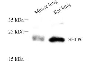 Western blot analysis of sftpc (ABIN7075216),at dilution of 1: 600 (Prosurfactant Protein C 抗体)