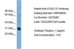 WB Suggested Anti-CCDC127  Antibody Titration: 0. (CCDC127 抗体  (N-Term))