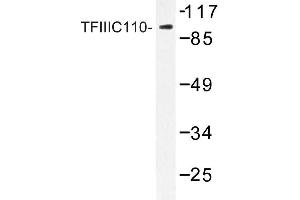 Image no. 1 for anti-General Transcription Factor IIIC, Polypeptide 2, beta 110kDa (GTF3C2) antibody (ABIN272244) (GTF3C2 抗体)