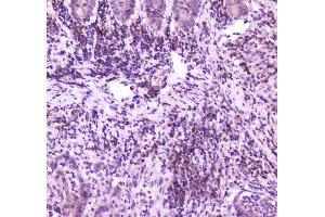 IHC analysis of PLCG 2 using anti-PLCG 2 antibody . (Phospholipase C gamma 2 抗体  (AA 1201-1258))