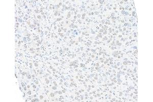 Immunohistochemistry (IHC) image for anti-Structural Maintenance of Chromosomes 1A (SMC1A) (C-Term) antibody (ABIN7455193)