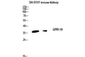 Western Blot (WB) analysis of SH-SY5Y Mouse Kidney lysis using GPR119 antibody. (G Protein-Coupled Receptor 119 抗体  (Internal Region))