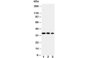 Western blot testing of HOXA4 antibody and Lane 1:  SW620;  2: SW620;  3: PC-12 cell Nuclear lysate (HOXA4 抗体  (N-Term))