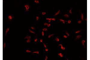 ABIN6266916 staining A549 cells by IF/ICC. (TNFAIP2 抗体)