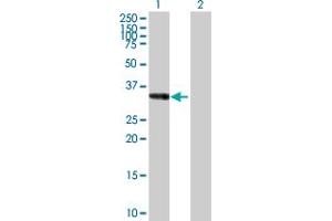 Western Blot analysis of GALE expression in transfected 293T cell line by GALE MaxPab polyclonal antibody. (GALE 抗体  (AA 1-348))