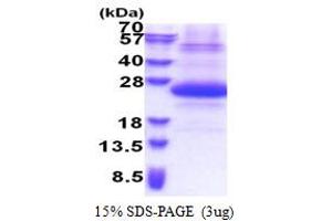 SDS-PAGE (SDS) image for Sjogren Syndrome/scleroderma Autoantigen 1 (SSSCA1) (AA 1-199) protein (His tag) (ABIN6387322) (SSSCA1 Protein (AA 1-199) (His tag))