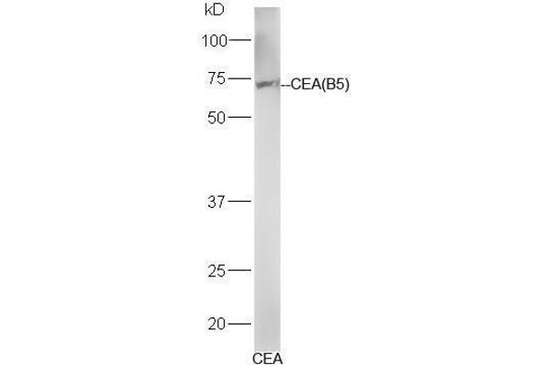 CEA 抗体