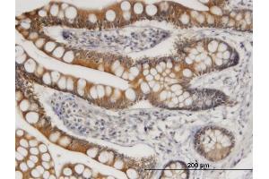 Immunoperoxidase of monoclonal antibody to TLR4 on formalin-fixed paraffin-embedded human small Intestine. (TLR4 抗体  (AA 214-291))