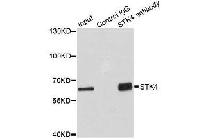 Immunoprecipitation (IP) image for anti-serine/threonine Kinase 4 (STK4) (AA 303-487) antibody (ABIN6148620)