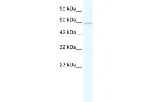 WB Suggested Anti-ZNF276 Antibody Titration:  1. (ZNF276 抗体  (Middle Region))
