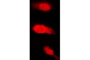 Immunofluorescent analysis of HuB staining in K562 cells. (HuB (Center) 抗体)