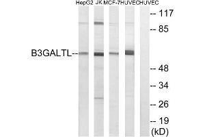 Western blot analysis of extracts from HepG2 cells, Jurkat cells, MCF-7 cells and HUVEC cells, using B3GALTL antibody. (B3GALTL 抗体  (C-Term))