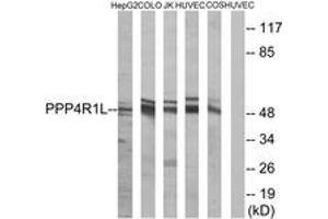 Western blot analysis of extracts from COLO/HuvEc/HepG2/Jurkat/COS cells, using PPP4R1L Antibody. (PPP4R1L 抗体  (AA 191-240))