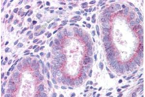 Human Uterus: Formalin-Fixed, Paraffin-Embedded (FFPE) (XCR1 抗体  (C-Term))