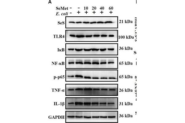 NF-kB p65 Antikörper  (pSer536)