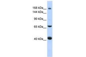 Image no. 1 for anti-ATP-Binding Cassette, Sub-Family C (CFTR/MRP), Member 9 (ABCC9) (AA 1440-1489) antibody (ABIN6740836) (ABCC9 抗体  (AA 1440-1489))