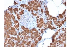 Immunohistochemistry (IHC) image for anti-Carboxypeptidase A1 (Pancreatic) (CPA1) antibody (ABIN6939171)