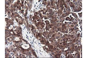 Image no. 6 for anti-F-Box Protein 21 (FBXO21) antibody (ABIN1498232) (FBXO21 抗体)