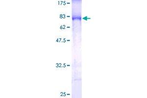 Image no. 1 for Inhibitor of kappa Light Polypeptide Gene Enhancer in B-Cells, Kinase gamma (IKBKG) (AA 1-419) protein (GST tag) (ABIN1307644)