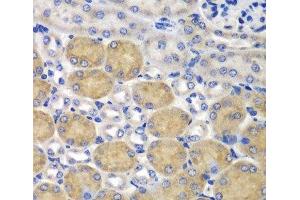 Immunohistochemistry of paraffin-embedded Mouse kidney using SND1 Polyclonal Antibody at dilution of 1:100 (40x lens). (SND1 抗体)