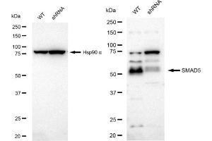 Western blotting analysis using SMAD5 antibody (ABIN7800374). (Recombinant SMAD5 抗体)