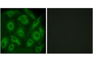 Immunofluorescence analysis of HeLa cells, using CDH23 Antibody. (CDH23 抗体  (AA 61-110))