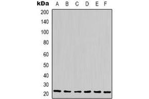 Western blot analysis of Cyclophilin B expression in Hela (A), Jurkat (B), 293T (C), HepG2 (D), NIH3T3 (E), rat liver (F) whole cell lysates. (PPIB 抗体)