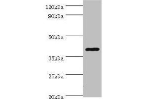 Western blot All lanes: HDAC11 antibody at 2 μg/mL + Mouse brain tissue Secondary Goat polyclonal to rabbit IgG at 1/10000 dilution Predicted band size: 40, 34 kDa Observed band size: 40 kDa (HDAC11 抗体  (AA 1-347))