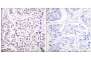A-peptide - + (Histone H4 抗体  (acLys5))