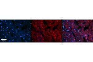 Rabbit Anti-INSR Antibody   Formalin Fixed Paraffin Embedded Tissue: Human Heart Tissue Observed Staining: Cytoplasm in cardiomyocytes Primary Antibody Concentration: 1:100 Other Working Concentrations: 1:600 Secondary Antibody: Donkey anti-Rabbit-Cy3 Secondary Antibody Concentration: 1:200 Magnification: 20X Exposure Time: 0. (Insulin Receptor 抗体  (Middle Region))