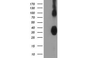 HEK293T cells were transfected with the pCMV6-ENTRY control (Left lane) or pCMV6-ENTRY ZFP36 (Right lane) cDNA for 48 hrs and lysed. (ZFP36 抗体)