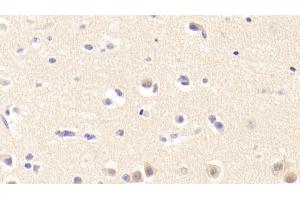 Immunohistochemistry (IHC) image for anti-Tenascin XB (TNXB) (AA 3835-4088) antibody (ABIN7434377)