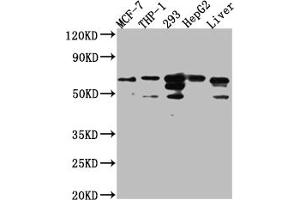 Western Blot Positive WB detected in: MCF-7 whole cell lysate, THP-1 whole cell lysate, 293 whole cell lysate, HepG2 whole cell lysate, Mouse Liver whole cell lysate All lanes: FAAH1 Antibody at 1:1000 Secondary Goat polyclonal to rabbit IgG at 1/50000 dilution Predicted band size: 64 kDa Observed band size: 64 kDa (Recombinant FAAH 抗体)
