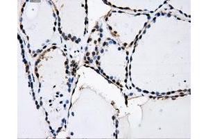 Immunohistochemical staining of paraffin-embedded Kidney tissue using anti-PKMYT1mouse monoclonal antibody. (PKMYT1 抗体)