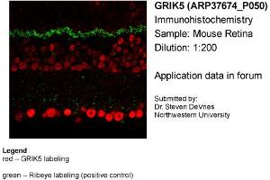 Sample Type: Mouse RetinaPrimary Dilution: 1:200