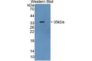 Detection of Recombinant HPS1, Mouse using Polyclonal Antibody to Hermansky Pudlak Syndrome Protein 1 (HPS1) (HPS1 抗体  (AA 1-275))