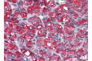 Immunohistochemistry (Paraffin-embedded Sections) (IHC (p)) image for anti-S-Phase Kinase-Associated Protein 2 (SKP2) (AA 221-425) antibody (ABIN5611444)
