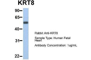 Host:  Rabbit  Target Name:  KRT8  Sample Type:  Human Fetal Heart  Antibody Dilution:  1. (KRT8 抗体  (Middle Region))