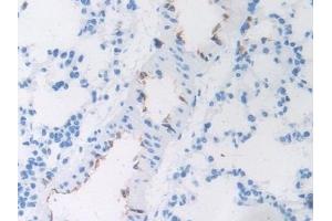 Immunohistochemistry (IHC) image for anti-Von Willebrand Factor (VWF) (AA 269-367) antibody (ABIN7438430)