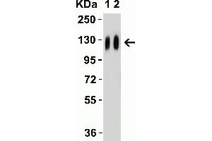 Western Blot Validation with SARS-CoV-2 (COVID-19) Spike Recombinant Protein Loading: 50 ng per lane of SARS-CoV-2 (COVID-19) Spike S1 recombinant protein (97-087. (SARS-CoV-2 Spike 抗体)