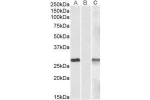 Western Blotting (WB) image for anti-DPY30 Domain Containing 1 (DYDC1) (Internal Region) antibody (ABIN2464411) (DYDC1 抗体  (Internal Region))