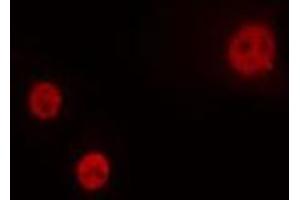 ABIN6274264 staining HeLa cells by IF/ICC. (HOXA1 抗体  (Internal Region))